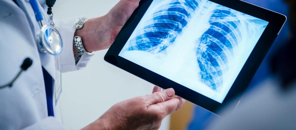 La cage thoracique : le bouclier méconnu qui protège nos organes vitaux